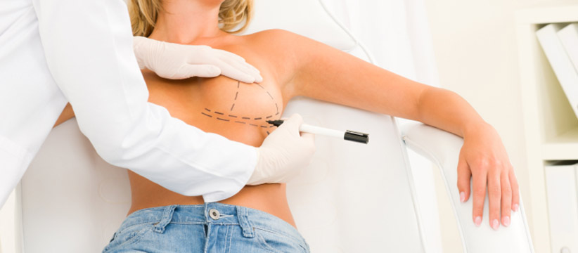 Breast Asymmetry Correction With Breast Augmentation Surgery